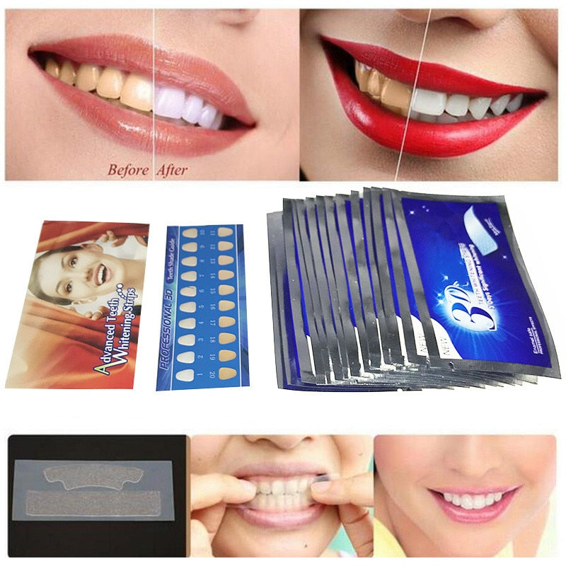 Tiras de gel blanqueador de dientes Heonyirry - 14 pares 